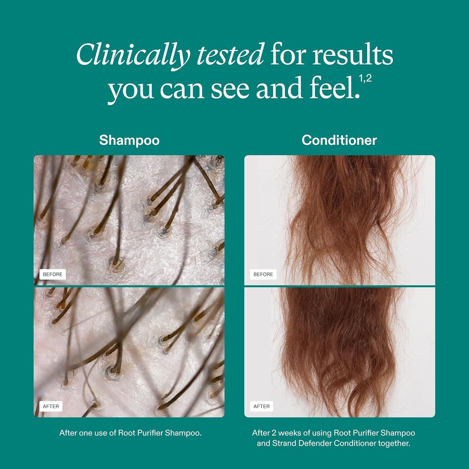 Nutrafol Shampoo and Conditioner for Thinning Hair, 8.1 Fl Oz